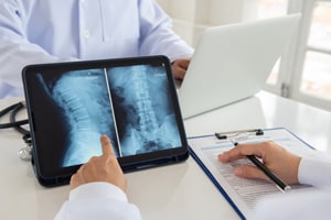 Gainesville, GA Spinal Cord Injuries Lawyer